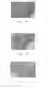 Fig. 03 - A USE OF HYPERTONIC SOLUTION COMPOSITION IN MANUFACTURING MEDICAMENTS FOR PROMOTING WOUND HEALING