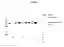 Fig. 02 - Process for the preparation of angiogenin