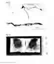 Fig. 12 - Warm spray coating method and particles used therefor