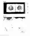 Fig. 20 - Warm spray coating method and particles used therefor