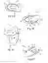 Fig. 02 - DEVICE FOR STORING AND DISPENSING COMPOSITIONS