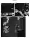 Fig. 35 - PHOTORECEPTOR PRECURSOR CELLS