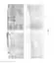 Fig. 02 - METHOD FOR DETECTING A CHRONIC INFLAMMATORY-ASSOCIATED DISEASE