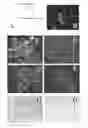 Fig. 01 - In vitro method for diagnosing prostate cancer