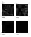 Fig. 05 - Encapsulation of cells in biologic compatible scaffolds by coacervation of charged polymers