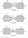 Fig. 02 - Device including a dissolvable structure for flow control