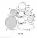 Fig. 06 - Device including a dissolvable structure for flow control