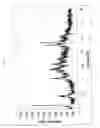 Fig. 07 - NOVEL CRYSTALLINE BEPOTASTINE METAL SALT HYDRATE, METHOD FOR PREPARING SAME, AND PHARMACEUTICAL COMPOSITION COMPRISING SAME