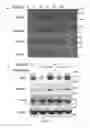 Fig. 09 - Compositions and Methods for the Treatment of Diseases Associated with Aberrant Cilia Assembly and Regulation