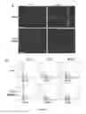 Fig. 12 - Compositions and Methods for the Treatment of Diseases Associated with Aberrant Cilia Assembly and Regulation