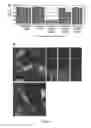 Fig. 15 - Compositions and Methods for the Treatment of Diseases Associated with Aberrant Cilia Assembly and Regulation