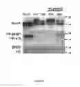 Fig. 16 - Compositions and Methods for the Treatment of Diseases Associated with Aberrant Cilia Assembly and Regulation