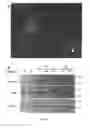 Fig. 17 - Compositions and Methods for the Treatment of Diseases Associated with Aberrant Cilia Assembly and Regulation