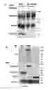 Fig. 26 - Compositions and Methods for the Treatment of Diseases Associated with Aberrant Cilia Assembly and Regulation