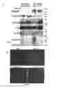 Fig. 27 - Compositions and Methods for the Treatment of Diseases Associated with Aberrant Cilia Assembly and Regulation