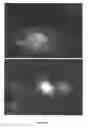 Fig. 29 - Compositions and Methods for the Treatment of Diseases Associated with Aberrant Cilia Assembly and Regulation