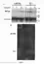 Fig. 30 - Compositions and Methods for the Treatment of Diseases Associated with Aberrant Cilia Assembly and Regulation