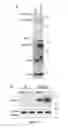 Fig. 41 - Compositions and Methods for the Treatment of Diseases Associated with Aberrant Cilia Assembly and Regulation