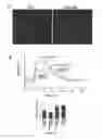 Fig. 53 - Compositions and Methods for the Treatment of Diseases Associated with Aberrant Cilia Assembly and Regulation