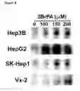 Fig. 09 - Methods and compositions for administration of 3-halopyruvate and related compounds for the treatment of cancer