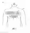 Fig. 02 - Apnea type determining apparatus and method