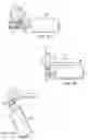 Fig. 07 - APPARATUS AND METHOD TO ACCESS THE BONE MARROW FOR ONCOLOGY AND STEM CELL APPLICATIONS
