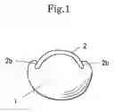 Fig. 02 - Apparatus for correcting an ingrown nail