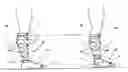 Fig. 01 - Compression or support stocking