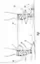 Fig. 02 - Compression or support stocking