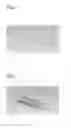 Fig. 02 - SPIRAL BALLOON CATHETER