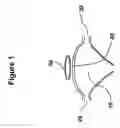 Fig. 02 - INTRA-PERICARDIAL PROTECTIVE DEVICE