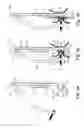 Fig. 05 - Surgical Instrument for Endoscopic Suturing of Deep Subcutaneous Tissue