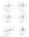 Fig. 02 - Tissue anchorable devices