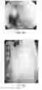 Fig. 07 - Tissue anchorable devices