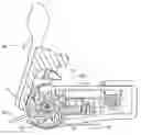 Fig. 01 - Adjustable tourniquet