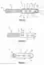 Fig. 02 - Graft fixation device
