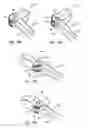 Fig. 08 - Variable angle spinal surgery instrument