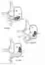 Fig. 09 - Variable angle spinal surgery instrument