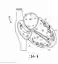 Fig. 02 - LV threshold measurement and capture management
