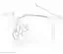 Fig. 01 - Intravascular medical device