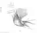 Fig. 22 - Intravascular medical device
