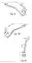 Fig. 07 - Method for directed intranasal administration of a composition