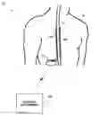 Fig. 01 - PATIENT-CENTRIC DATA COLLECTION FOR AUTOMATED MRI COMPATIBILITY VERIFICATION