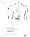 Fig. 02 - PATIENT-CENTRIC DATA COLLECTION FOR AUTOMATED MRI COMPATIBILITY VERIFICATION