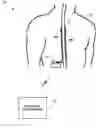 Fig. 01 - Patient programmer with automated MRI compatibility verification for active implantable medical device