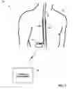 Fig. 02 - Patient programmer with automated MRI compatibility verification for active implantable medical device