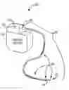 Fig. 01 - Medical electrical lead with backfilled electrode sub-assembly