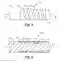 Fig. 06 - Medical electrical lead with backfilled electrode sub-assembly