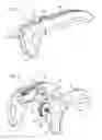 Fig. 02 - DEVICE FOR CONTROLLING A CATHETER