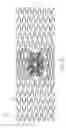 Fig. 08 - Stent with Graduated Stiffness